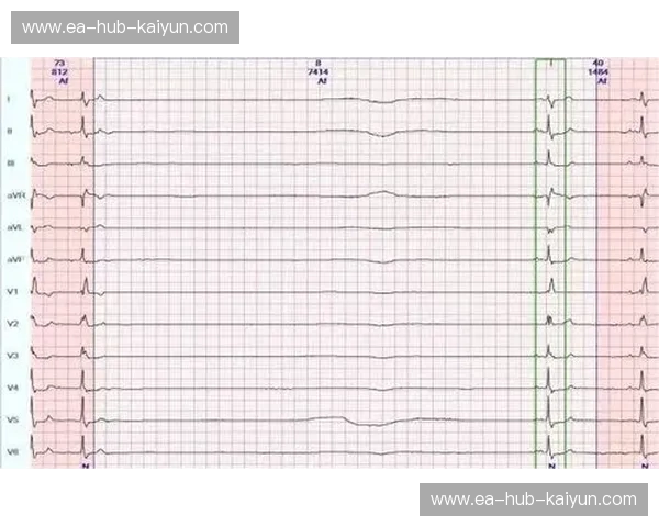 水球伤病全解析：从风险到康复的科学指南